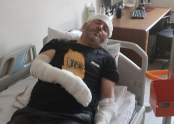 Piknik alanında yakılan çöpler patladı: 1’i çocuk 2 yaralı