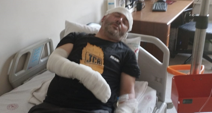 Piknik alanında yakılan çöpler patladı: 1’i çocuk 2 yaralı