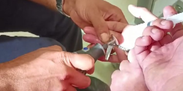 Yüzük sıkışan parmağı itfaiye ekipleri kurtardı